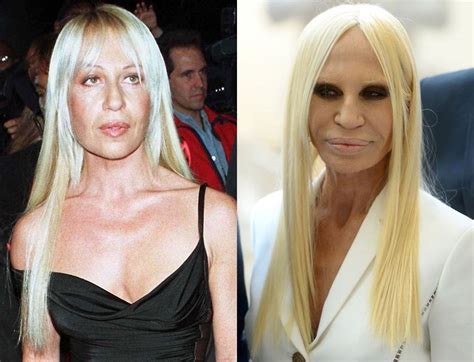 donatella versace biografía|donatella versace before and after surgery.